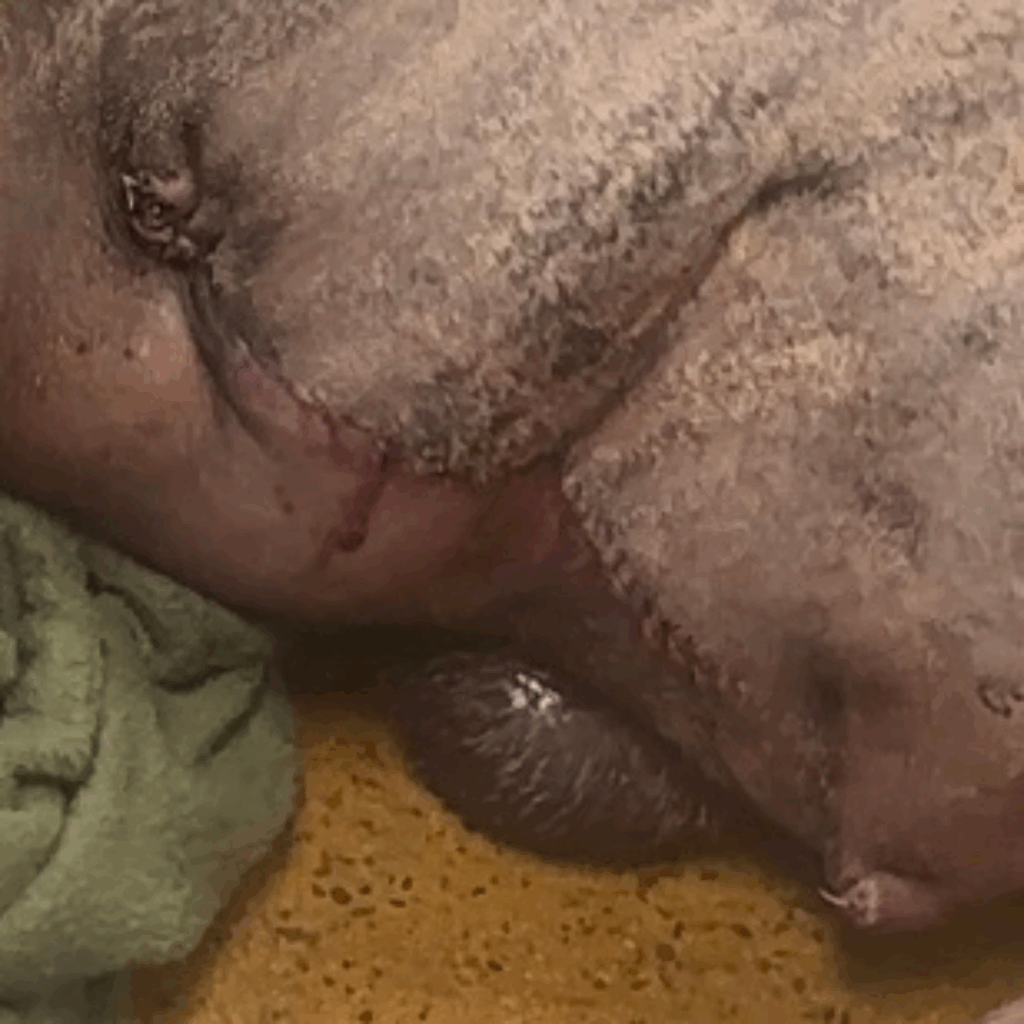 Close-up of Dior’s surgical incision site showing sutures and mild bleeding along the inner thigh.